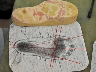 外反母趾の方の足型製作と図面